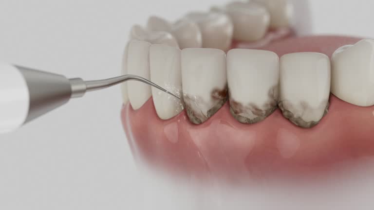Reliable Dental Implants contractor in Laurel, MT by Smile Center Dentistry